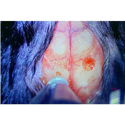 Fibre optic cannula implantation via Digital Microscope